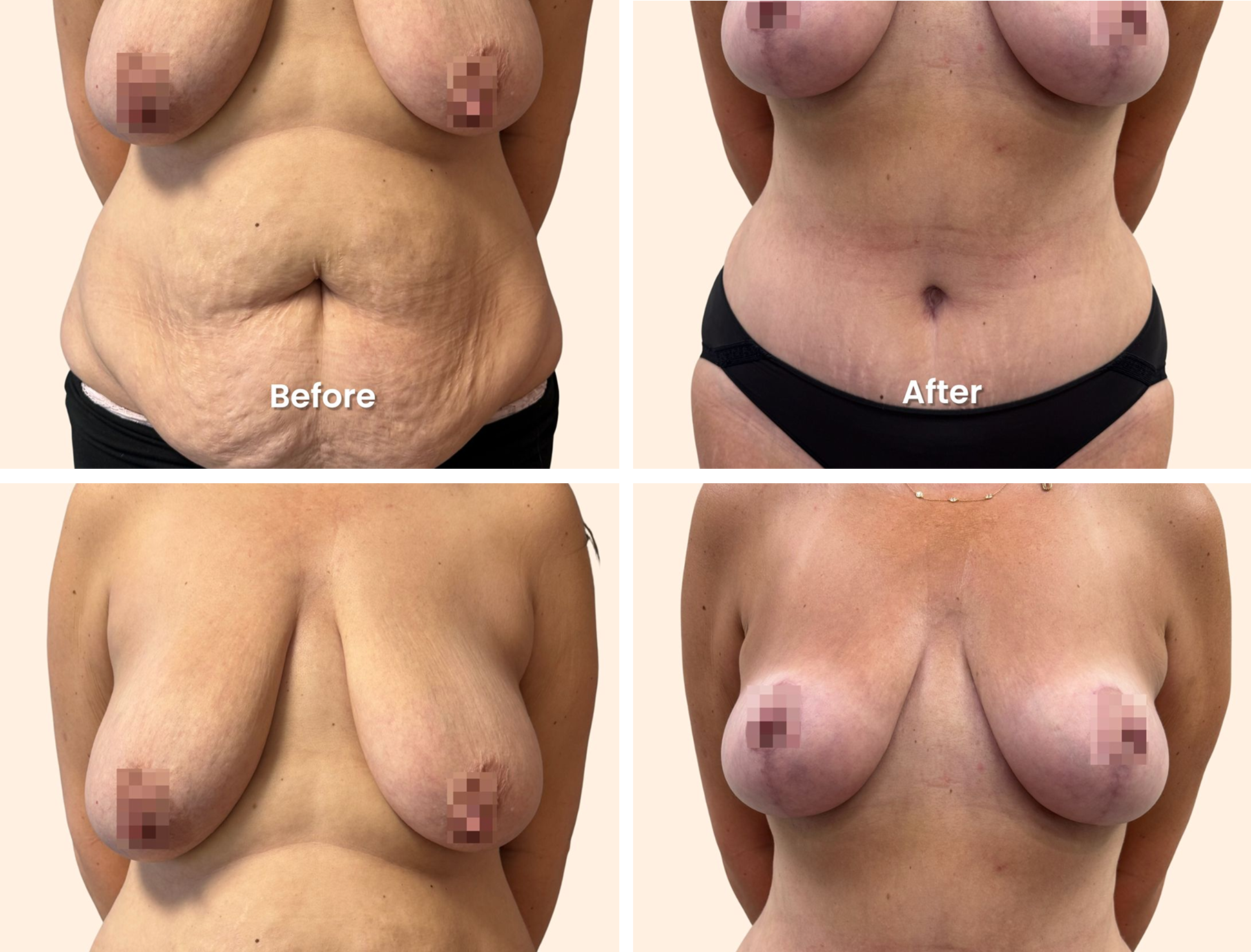 before-and-after-.png