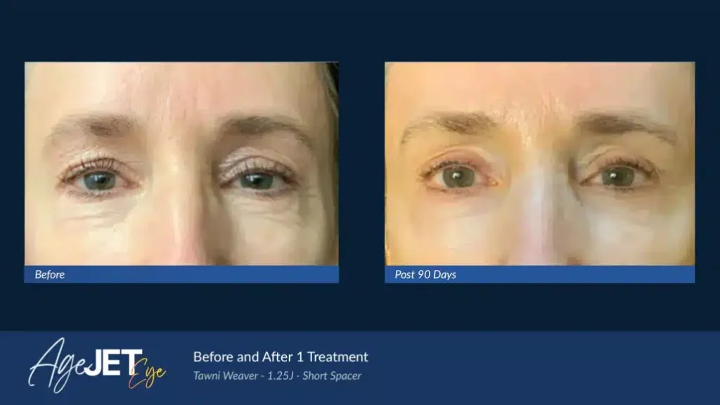 06-BA_AgeJET-Eye-Female-_-Weaver-1